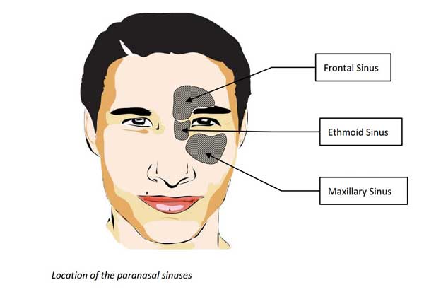 location of sinuses